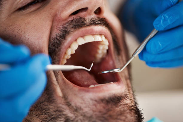 Best Emergency Dental Extractions in Prichard, AL